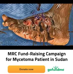 MRC Fund-Raising Campaign for Mycetoma Patient in Sudan