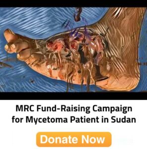 Donate for Myctoma in Sudan