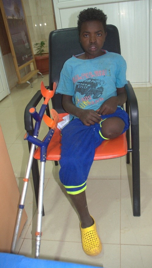 Late clinical presentation ended in above-knee amputation with lifelong misery.